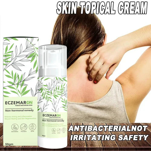Fungal out Anti - Fungal Spray (Buy 1 Get1 Free)
